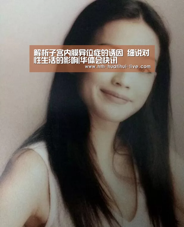 解析子宫内膜异位症的诱因 细说对性生活的影响|华体会快讯(图3) 华体会官方